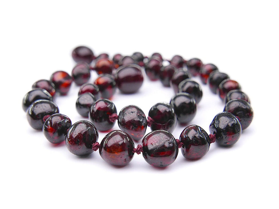 Joyería natural de ámbar báltico cereza oscura, tobillera perfecta para aliviar molestias