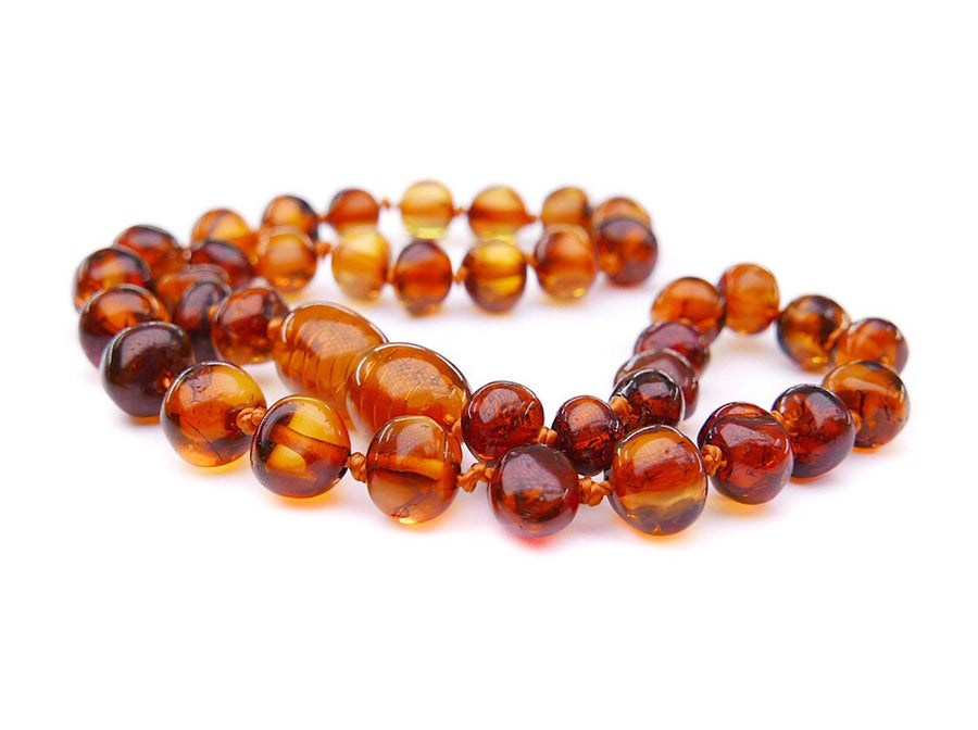 Tobillera de ámbar báltico con cuentas barrocas color coñac, combinación de estilo y beneficios naturales