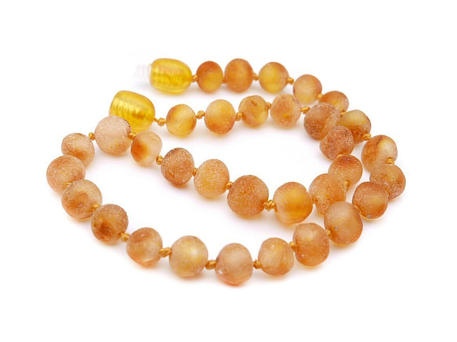 Joyería natural de ámbar báltico crudo miel, tobillera curativa con cuentas barrocas