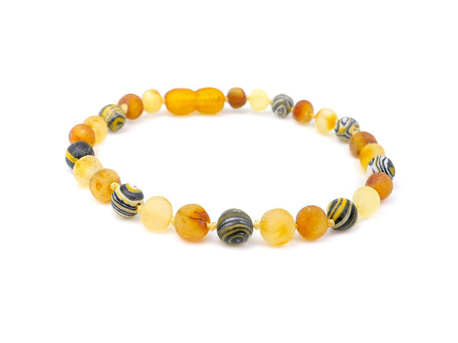 Pulsera de ámbar curativa para la artritis