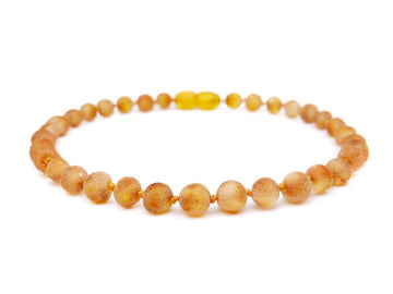 RAW HONEY BALTIC AMBER ADULT ANKLET