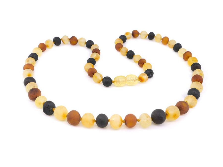 Collar artesanal de ámbar báltico crudo y sin tratar, perfecto para alivio natural del estrés