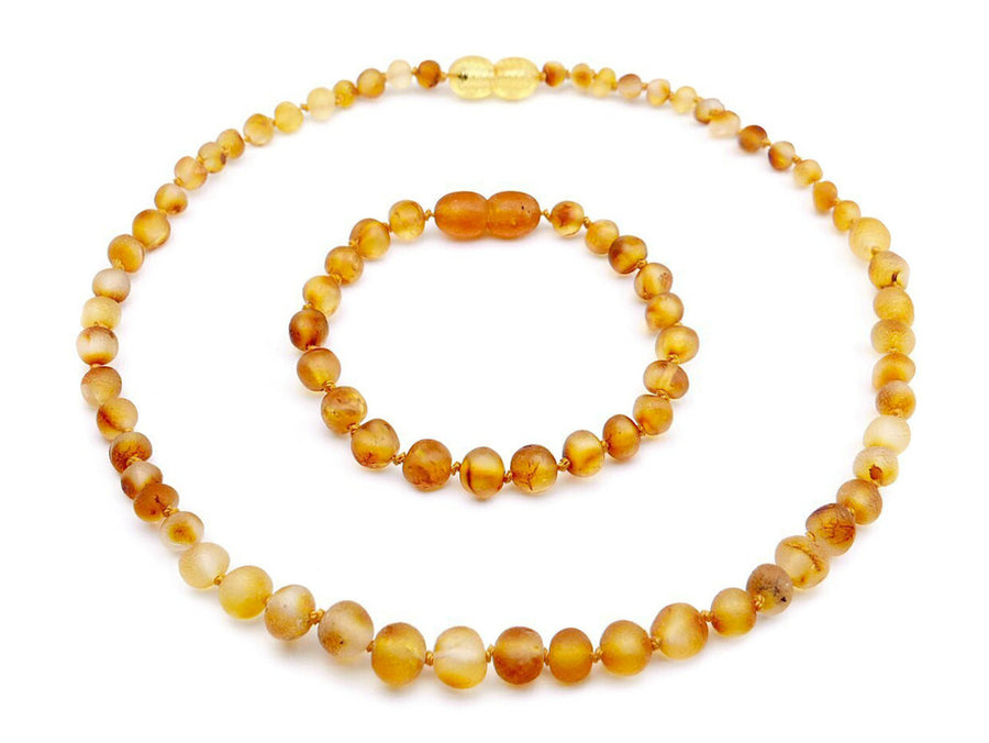 Collar y pulsera de ámbar natural en color miel, alivio natural para el malestar de la dentición