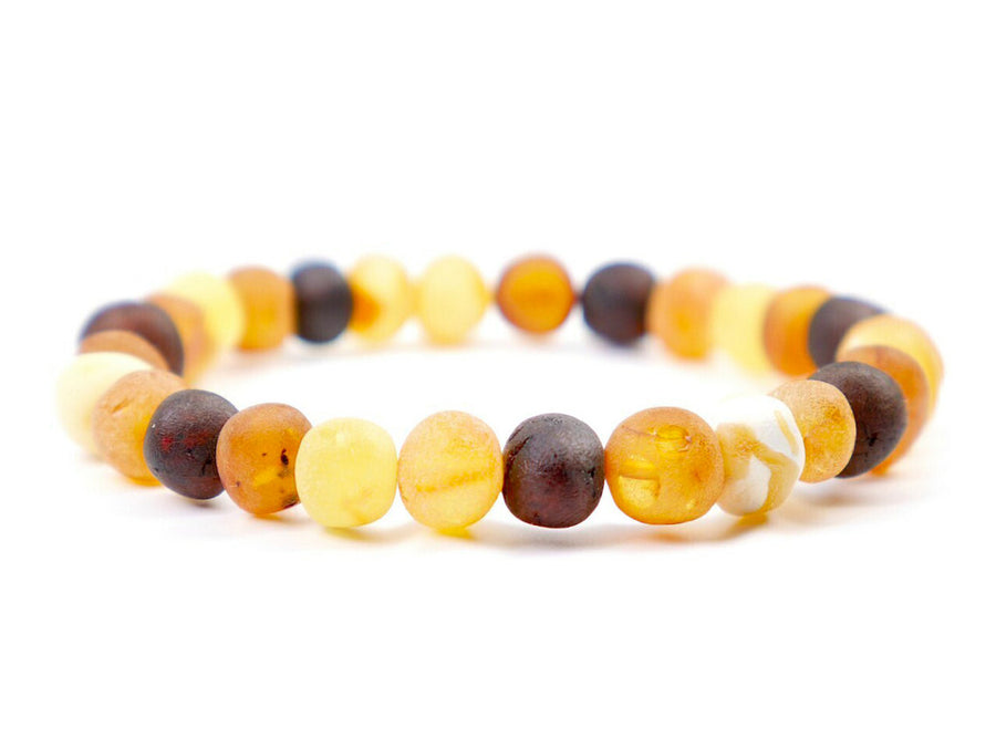 pulsera de ámbar para que sirve