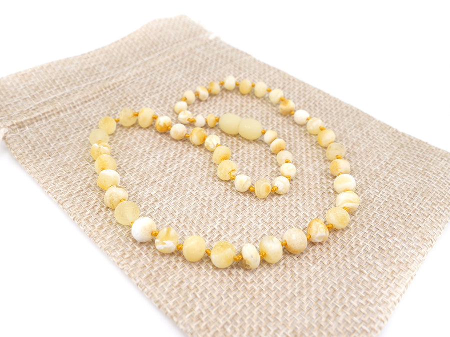 Cuentas de dentición de ámbar