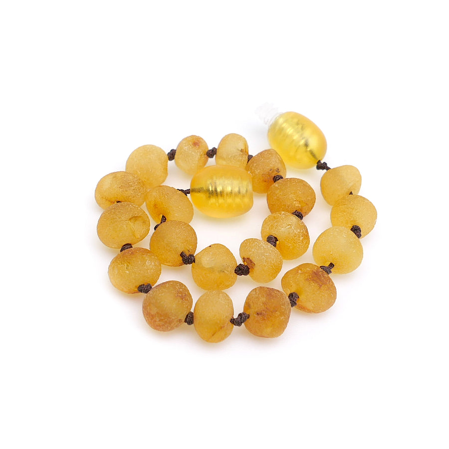 Tobillera de ámbar natural color miel con cuentas barrocas
